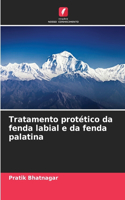 Tratamento protético da fenda labial e da fenda palatina