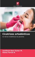 Cicatrizes ortodônticas