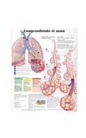 Understanding Asthma Anatomical Chart in Spanish (Entendiendo El Asma)