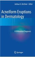 Acneiform Eruptions in Dermatology: A Differential Diagnosis