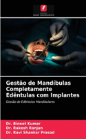 Gestão de Mandíbulas Completamente Edêntulas com Implantes