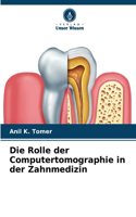 Rolle der Computertomographie in der Zahnmedizin