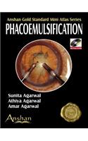 Mini Atlas of Phacoemulsification