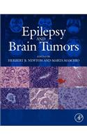 Epilepsy and Brain Tumors