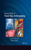Essentials in Total Hip Arthroplasty