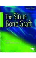 The Sinus Bone Graft