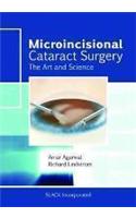 Microincisional Cataract Surgery