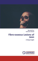 Fibro-osseous Lesions of Jaws