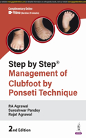 Step by Step: Management of Clubfoot by Ponseti Technique