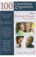 100 Questions & Answers about Prostate Cancer