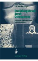 Ermüdungsbruch Durch Osteoporose
