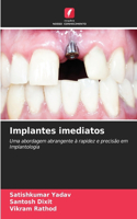 Implantes imediatos