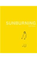 Sunburning