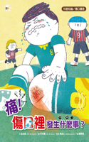 It Hurts! What's Going on Inside the Wound?