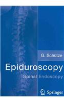 Epiduroscopy