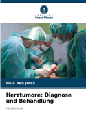Herztumore
