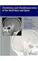 Chordomas and Chondrosarcomas of the Skull Base and Spine