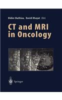 CT and MRI in Oncology