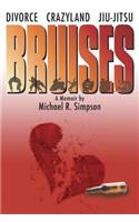 Bruises