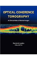 Optical Coherence Tomography a Clinical Atlas of Retinal Images