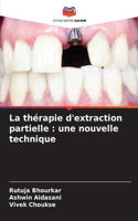 thérapie d'extraction partielle