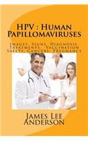 Hpv: Human Papillomaviruses: Images, Signs, Diagnosis, Treatments, Vaccination Safety, Cancers, Pregnancy(English)