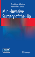 Mini-Invasive Surgery of the Hip