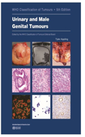 Urinary and Male Genital Tumours