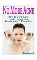 No More Acne