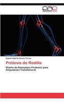 Protesis de Rodilla