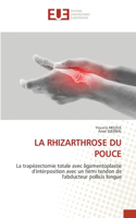 Rhizarthrose Du Pouce