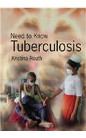 Need to Know: Tuberculosis Hardback