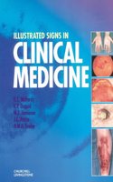 Illustrated Signs in Clinical Medicine