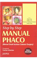 Step by Step Manual Phaco