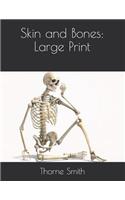 Skin and Bones