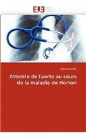 Atteinte de l''aorte Au Cours de la Maladie de Horton