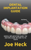 Dental Implantation Guide