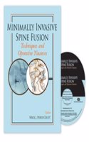 MINIMALLY INVASIVE SPINE FUSION 2