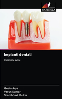 Impianti dentali