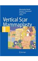 Vertical Scar Mammaplasty