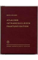 Atlas Der Intramedullaren Frakturfixation Nach Rush: Ein Behandlungssystem