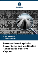 Stereomikroskopische Bewertung des vertikalen Randspalts bei PFM-Kappen