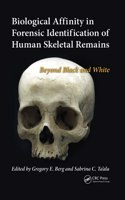 Biological Affinity in Forensic Identification of Human Skeletal Remains