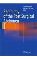 Radiology of the Post Surgical Abdomen