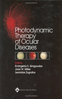 Photodynamic Therapy of Ocular Diseases