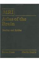 MRI Atlas of the Brain