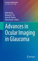 Advances in Ocular Imaging in Glaucoma