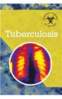 Tuberculosis