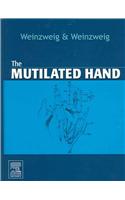 The Mutilated Hand