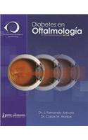 Diabetes en Oftalmologia